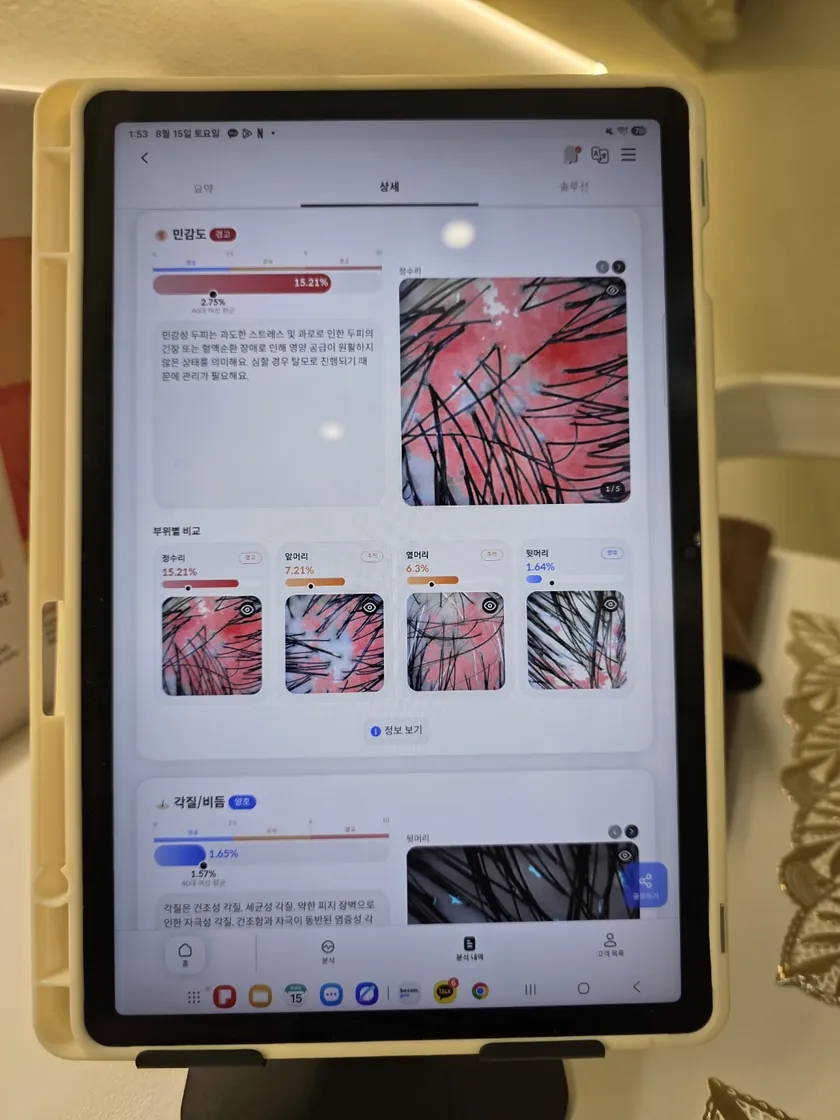 태블릿 화면으로 두피 상태를 확인하는 과정